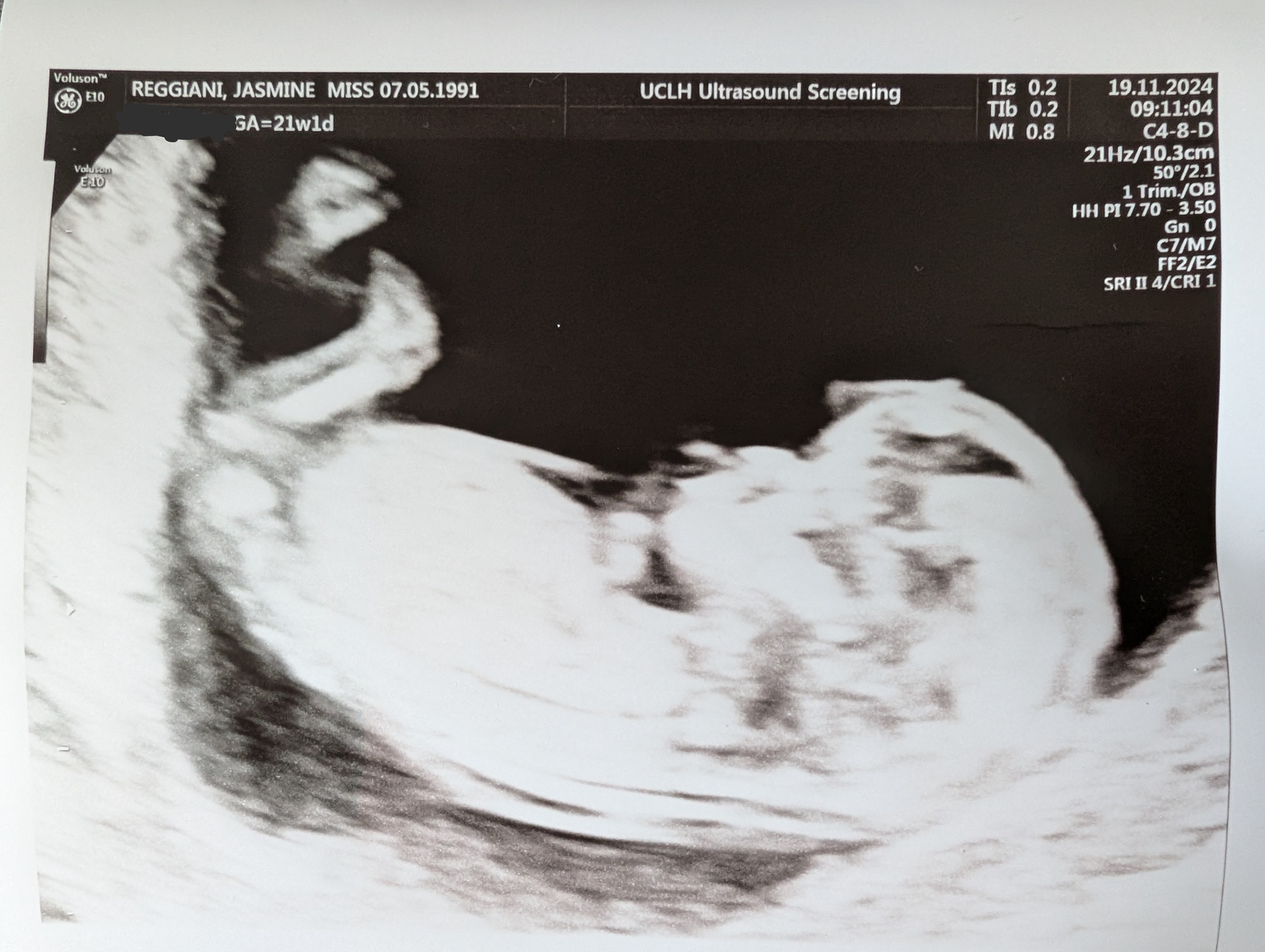 First time we saw Pemi!